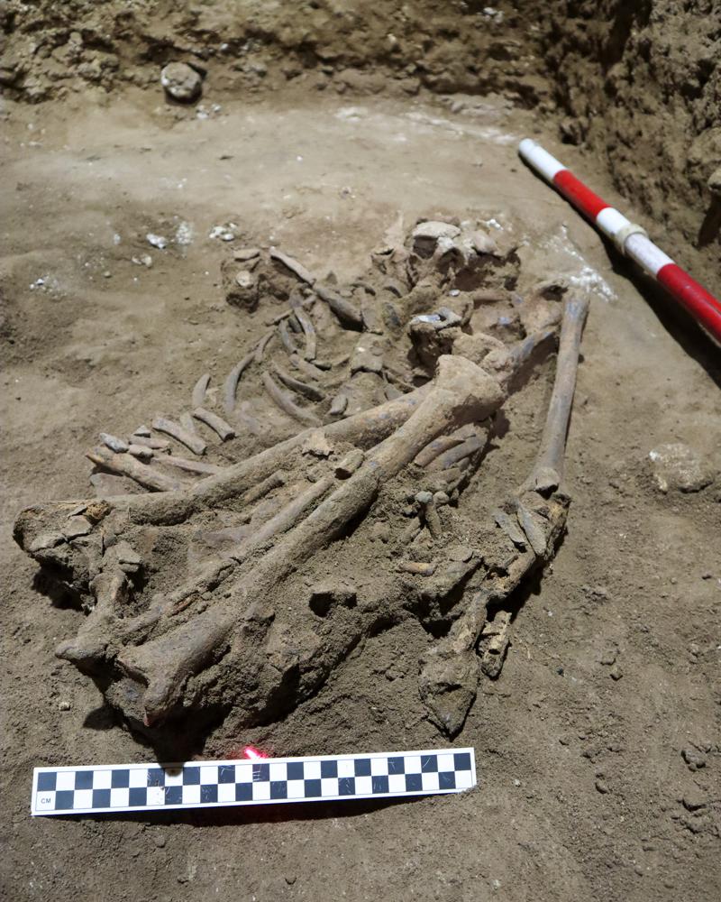 World's oldest amputation rewrites existing understanding of prehistoric medicine
